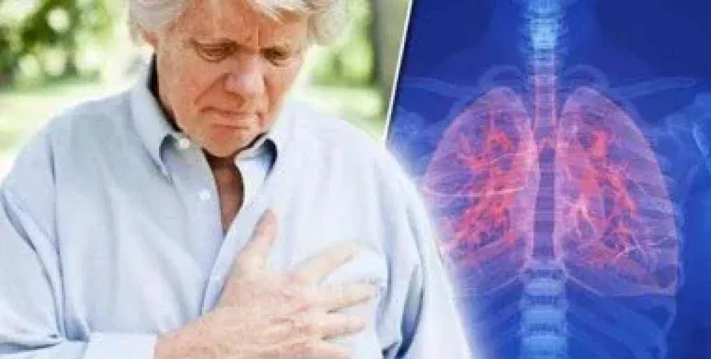 في اليوم العالمي لسرطان الرئة.. المرض لا يقتصر على المدخنين وهذه عوامل الخطر الصامتة