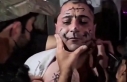 اعتداء صادم على الفنان عمر خيري في مدينة الباب بسوريا