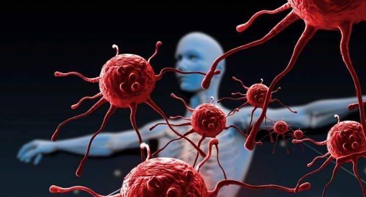 ارتفاع معدلات السرطان بين الشباب يثير القلق: نمط الحياة الحديثة في دائرة الاتهام