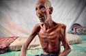 سليم عصفور.. جسد يذوب جوعًا في غزة وصورة تصرخ في وجه العالم