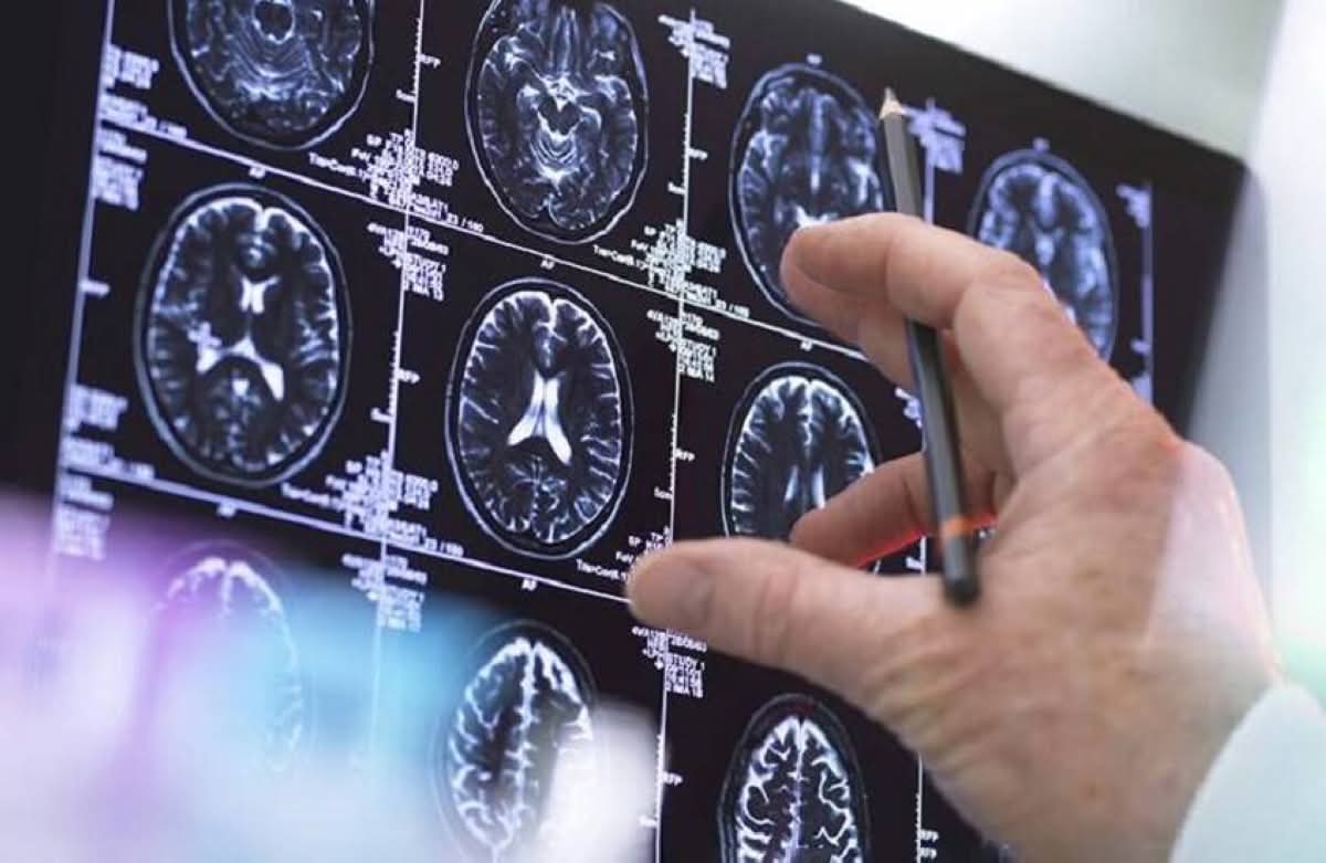 دراسة: الأطعمة الغنية بالنشا تقلل الإصابة بسرطانات الجهاز الهضمي