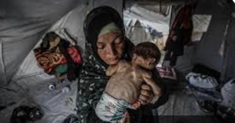 8 وفيات في غزة نتيجة المجاعة خلال 24 ساعة