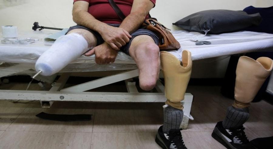 الميداني الأردني جنوب غزة 7: تركيب أكثر من 535 طرفا اصطناعيا في غزة