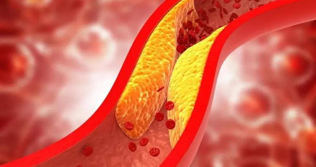 لا يعرفها كثير من الناس.. مشروبات بسيطة لخفض الكوليسترول وتعزيز صحة القلب