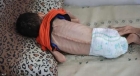 تجويع غزة: ارتقاع شهداء التجويع إلى 251 شهيداً بينهم 110 طفلا