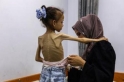 4 منظمات أممية تطالب بوقف إطلاق النار في غزة وإنقاذ المدنيين من المجاعة