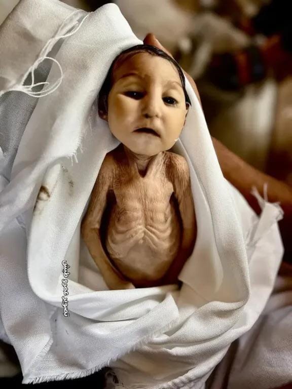وفاة الرضيعة.. ”غدير” في غزة من سوء التغذية