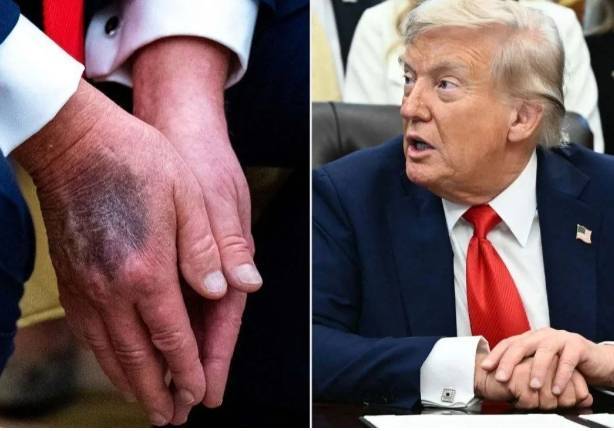 وسم (ترمب ميت) يتصدر منصات التواصل وترقب للكشف عن أسباب تغيبه