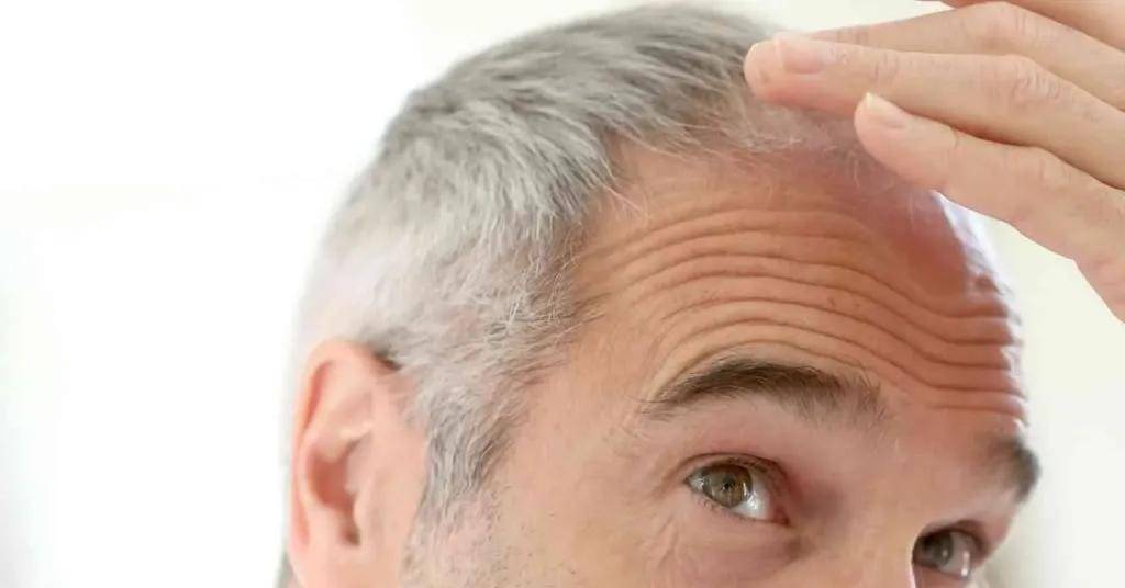 حقن علاج الشيب تثير الجدل في الصين.. حقيقة أم وهم طبي؟