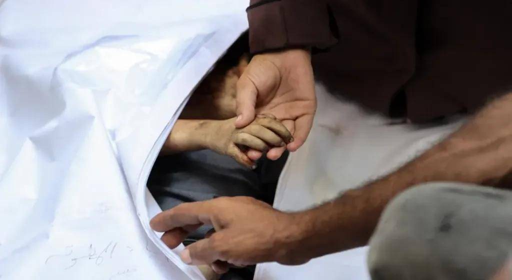 تجويع غزة.. 7 وفيات جديدة بينهم طفلان ترفع حصيلة الجوع إلى 420