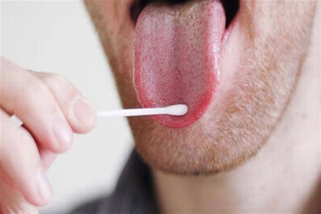 لسانك يكشف صحة قلبك.. كيف تكون مؤشراً مبكراً لمشاكل القلب