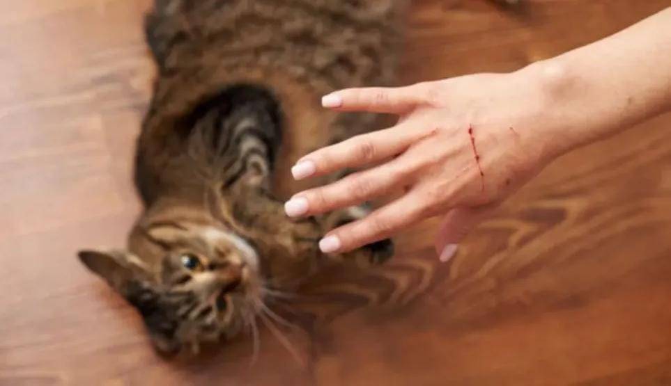 خدش القطط قد ينقل أمراض خطيرة.. أبرزها داء الكلب ومرض خدش القطط