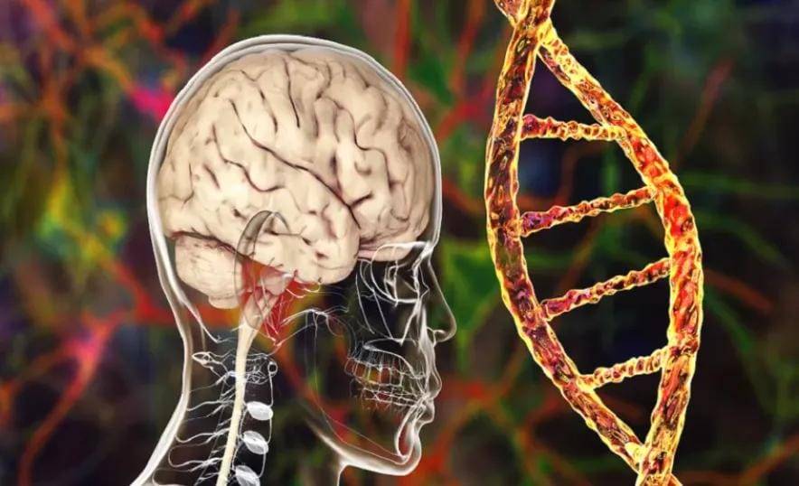 ثورة في الطب العصبي.. علاج هنتنغتون يحقق نتائج غير مسبوقة