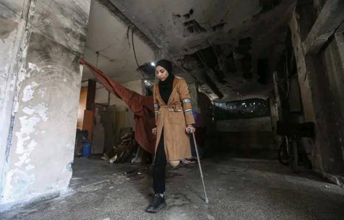الصحة في غزة: 4800 حالة بتر موثقة.. والنساء يتحملن المعاناة الأكبر