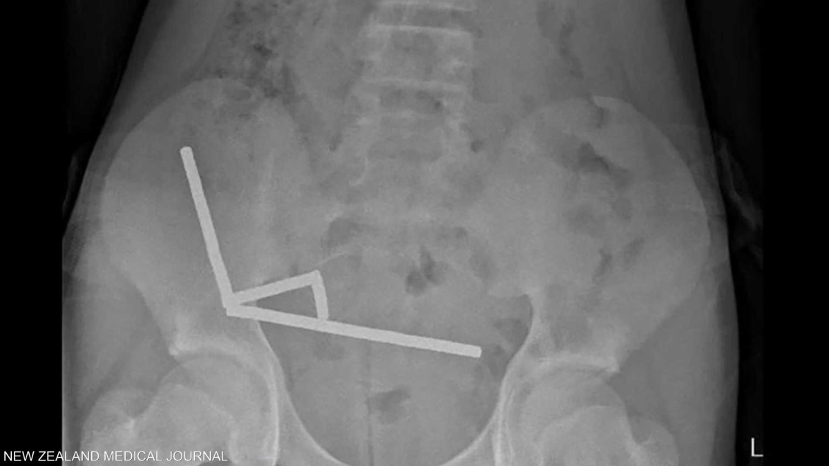 رصد 3 ثورات لبركان في الفلبين