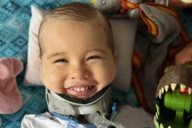 مؤسسة توني كروس وطبيب لبناني ينقذان حياة طفل من إصابة غير متوافقة مع الحياة