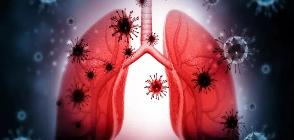 طبيب أردني يحذر من انتشار الالتهابات التنفسية ويوضح الأعراض المشتركة