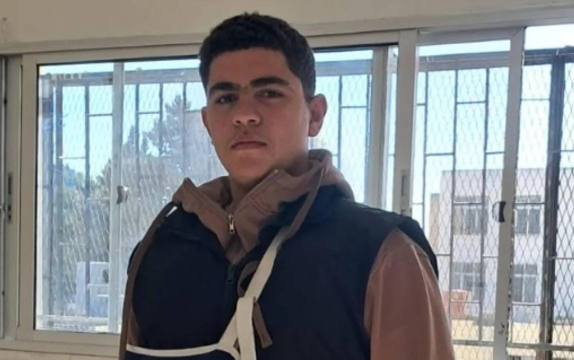 طالب ثانوي ينقذ طفلًا من حريق في النزهة ويُصاب بكسر خلال عملية الإنقاذ