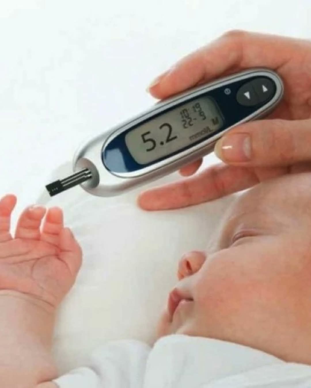 نوع جديد من سكري الأطفال حديثي الولادة مرتبط بخلل جيني نادر