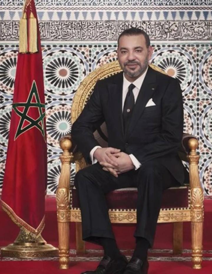 ملك المغرب يعاني من ألم في أسفل الظهر مع تشنج عضلي