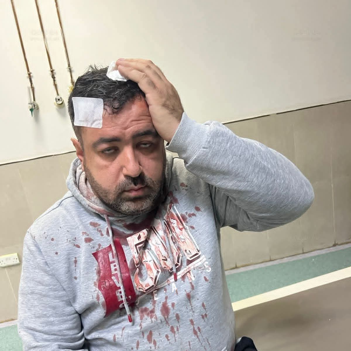 الاعتداء على الصحفي فيصل التميمي أمام منزله في الزرقاء