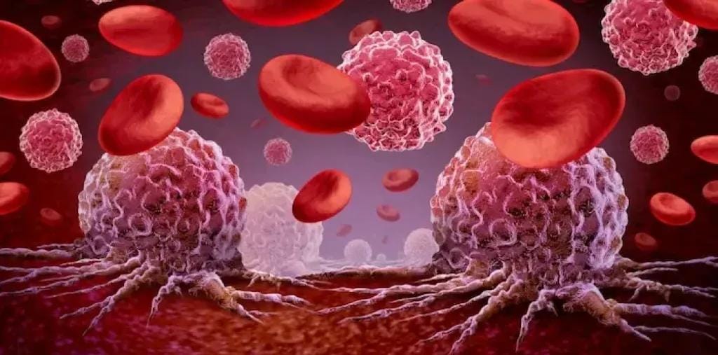 تجنب الإصابة بالسرطان بهذه الخطوات