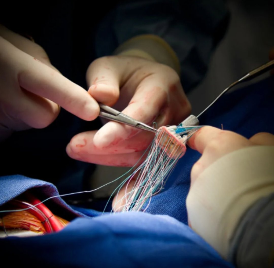 وزارة الصحة : توزيع حالات القسطرة الطارئة بين مستشفيات البشير والأمير حمزة والزرقاء والكرك والطفيلة