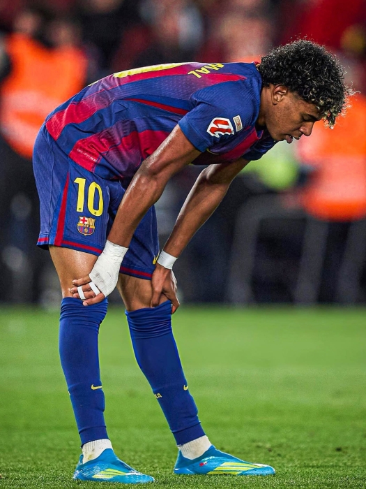 الإصابة تبعد لاعب برشلونة لامين يامال عن الملاعب حتى نهاية الموسم