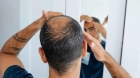 دراسة تفاجئ الرجال.. الصلع المبكر قد يقلل خطر الإصابة بسرطان البروستاتا